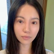 劉志剛院長(zhǎng)做眼睛收費(fèi)貴嗎？?jī)r(jià)格表及雙眼皮案例在線分享