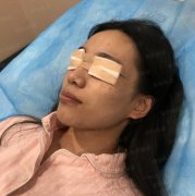 愛德麗格雙眼皮價格表_王香平雙眼皮果好嗎?案例分享