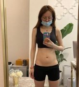 河南省人民醫(yī)院整形科腰腹吸脂案例展示！再看抽脂價格表