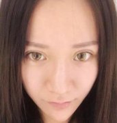 北京八大處趙延勇擅長什么？鼻部手術(shù)整形案例公布！含收費(fèi)詳情