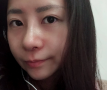 深圳美萊整形美容醫(yī)院隆鼻案例反饋如下~還有價(jià)格收費(fèi)表明細(xì)參考