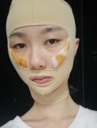 北京八大處顴骨內(nèi)推怎么樣？專家案例和價格表出爐!