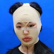 西安西京醫(yī)院整形科顴骨內(nèi)推怎么樣？專家案例果反饋！價格表清單一覽！