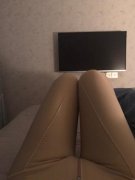 溫州醫(yī)科大學(xué)附屬第二醫(yī)院整形科吸脂怎么樣？價格及案例前后變化圖公開