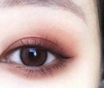 割雙眼皮一般要多少錢?什么時候割雙眼皮合適?