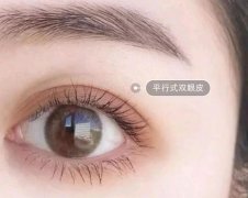 割雙眼皮需要注意什么?割雙眼皮有風(fēng)險嗎?