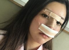 鄭大一附院整形科做鼻子怎么樣？醫(yī)生案例及價格價目表公開反饋
