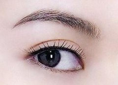 抬眉手術(shù)需要多長時間恢復(fù)?抬眉手術(shù)可以持續(xù)幾年?