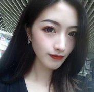 重醫(yī)附二院整形科怎么樣？快來(lái)參考埋線雙眼皮案例及價(jià)格價(jià)目表