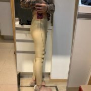 新疆醫(yī)科大學(xué)第一附屬醫(yī)院整形科怎樣？通過(guò)真實(shí)吸脂案例對(duì)比讓你明白