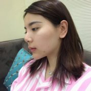 上海長(zhǎng)征醫(yī)院整形科面部吸脂怎么樣？術(shù)后瘦臉果跟美顏相機(jī)說再見！