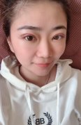 上海伯思立醫(yī)療美容做雙眼皮好嗎？有案例恢復(fù)果圖為證！