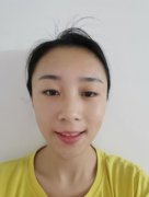 一覽北京潤(rùn)美玉之光自體脂肪全臉填充案例！醫(yī)生審美很在線