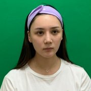 成都華美紫馨是熱瑪吉授權(quán)醫(yī)院嗎？資質(zhì)證書、案例果圖及價格全網(wǎng)對比