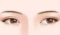 切開雙眼皮要花多少錢呢?切開雙眼皮能持續(xù)多久？