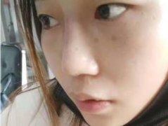 成都華美紫馨醫(yī)院口碑怎么樣？隆鼻案例_收費價格來講述