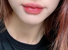 2022玻尿酸豐唇價(jià)格表？整形成嘟嘟唇怎么樣?怎么做的?