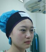 北醫(yī)三院整形科做雙眼皮怎么樣？看下列案例及價(jià)格表早了解果