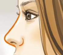 肋軟骨隆鼻后多久鼻子會變軟?