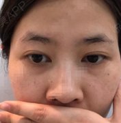 重慶當(dāng)代整形美容醫(yī)院面部提升案例果圖+價(jià)格收費(fèi)明細(xì)
