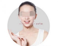 自身脂肪填充下巴禁忌人群有哪些?