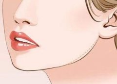 誰不適合做下頜角手術(shù)?下頜角手術(shù)后需要注意什么?