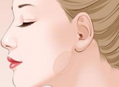 廣州下頜削骨整容整形要多少錢?影響下頜骨截骨術(shù)需要多少錢的因素有哪些?