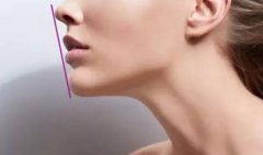 打透明質(zhì)酸豐下巴多久變軟?打透明質(zhì)酸豐下巴注意事項有哪些?