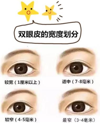 微創(chuàng)定位雙眼皮持久嗎?微創(chuàng)雙眼皮手術(shù)的特點(diǎn)