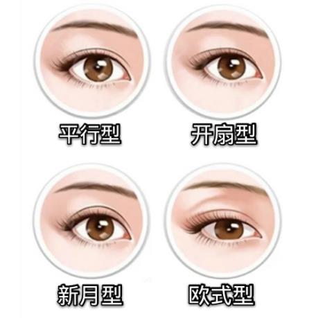 切開雙眼皮是長(zhǎng)期的嗎?埋線好還是切開雙眼皮比較好?