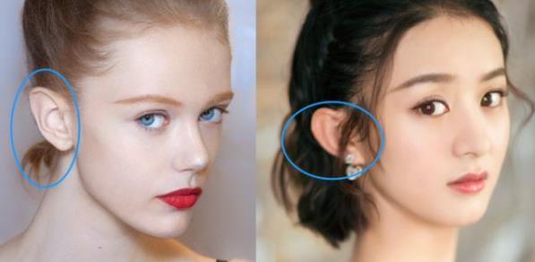 網(wǎng)紅都愛顱耳角在30°-60°之間？顱耳角在30°-60°之間到底值不值得做？玻尿酸注射精靈兒注意事項(xiàng)盤點(diǎn)