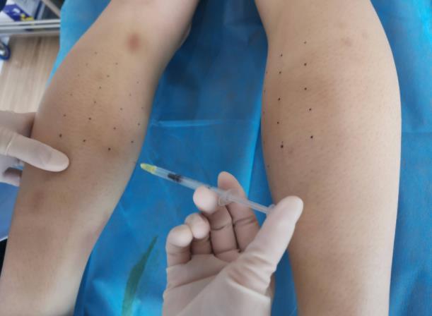 注射瘦腿到底有用嗎？哪些人不適合打注射瘦腿呢?注射瘦腿適用范圍盤點(diǎn)