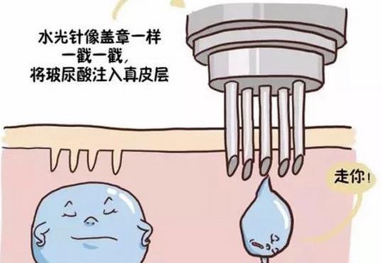 水光補(bǔ)水的副作用有哪些?是時(shí)候爆給大家了!