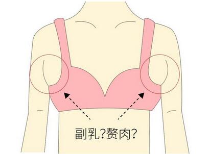 副乳是怎么來的?副乳的外觀和性能特點(diǎn)是什么?