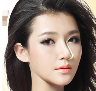 鼻尖大、鼻尖下垂怎么辦?鼻子整形方法匯總