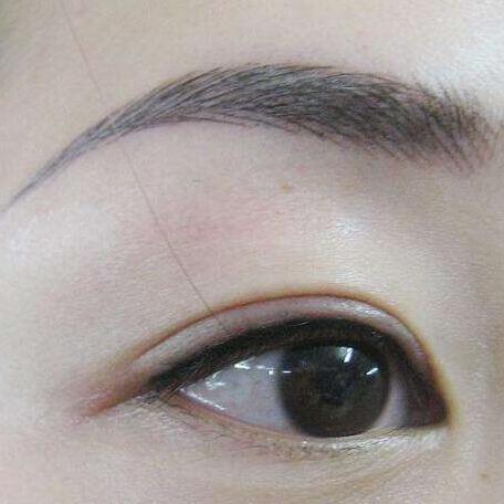 紋眉前后的注意事項(xiàng)