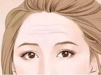 注射抬頭紋注射除皺后遺癥