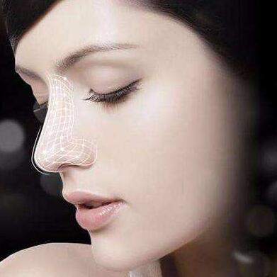 鼻翼縮小需要多長時間后拆線?