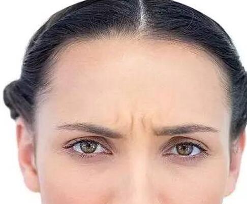 川字紋可以打肉毒毒素嗎，川字紋打肉毒毒素有沒有副作用?