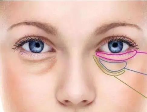 超聲提拉能去眼袋嗎？