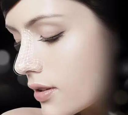 耳軟骨墊鼻尖取出后恢復(fù)期的注意事項(xiàng)是什么