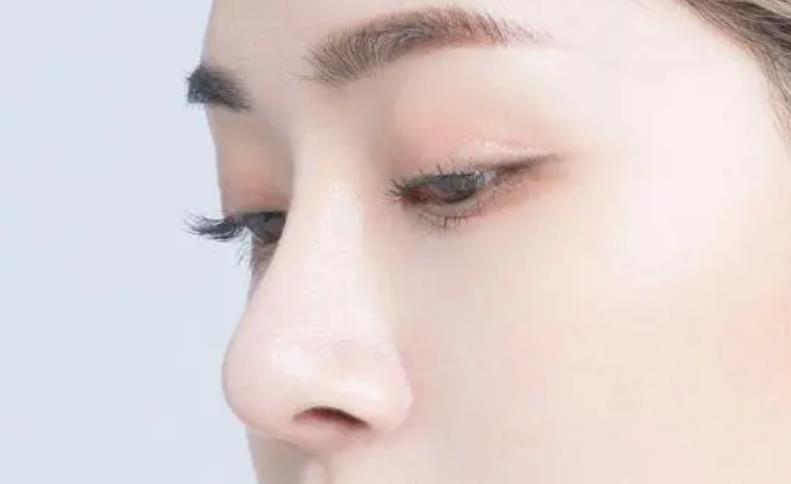 達拉斯隆鼻能持續(xù)多久?