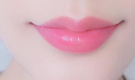 哪些因素影響豐唇的價格？