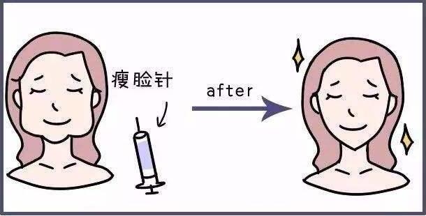 注射瘦臉毒素和減脂的區(qū)別，注射瘦臉毒素的注射心得