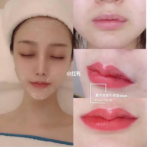 厚嘴唇的原因是什么?影響嘴唇形狀的不好習慣有哪些?