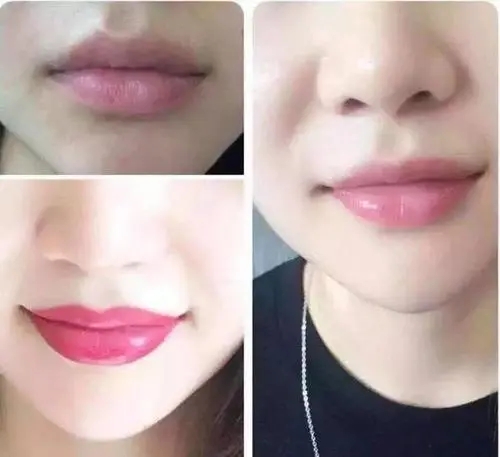 漂唇的價(jià)格是多少?