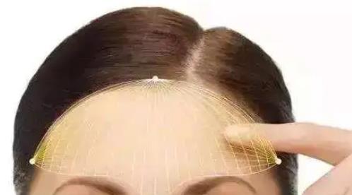 自體脂肪填充的額頭怎么樣？