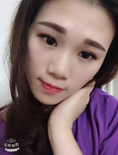 打完水光針的效果很好