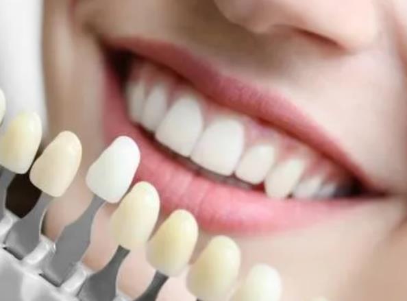 為什么瓷牙這么貴?