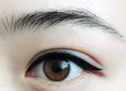 紋眼線怎么樣？好不好?消腫需要多長時間？